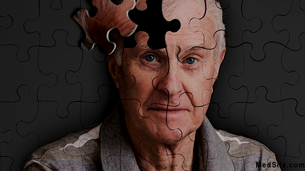 Корсаковский синдром